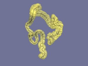 Virtuálna kolonoskopia